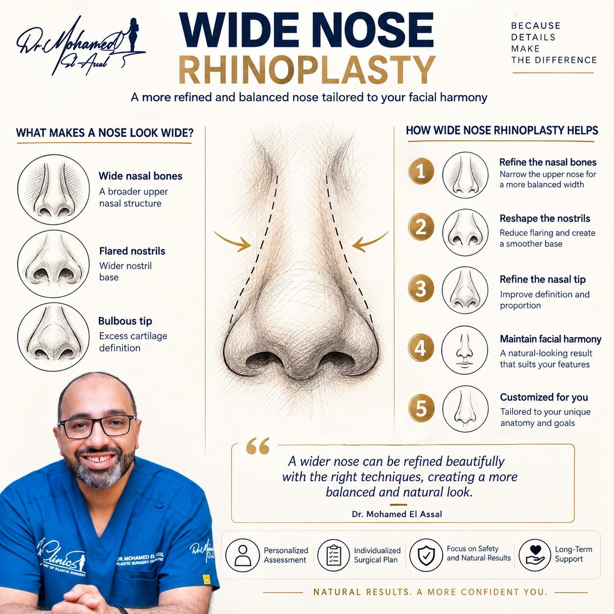Infographic explaining wide nose rhinoplasty, nasal bone refinement and nostril reshaping