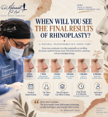Infographic showing when final rhinoplasty results appear